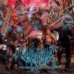 Vulvodynia - Praenuntius Infiniti Review